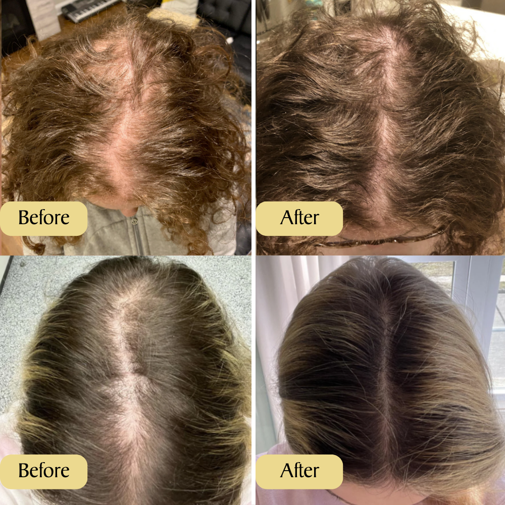Veganik Naturals Hair Growth Oil- Buy 1 Get 1 FREE